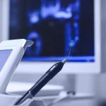 Benefits of Getting north vancouver dental implants for Missing Teeth